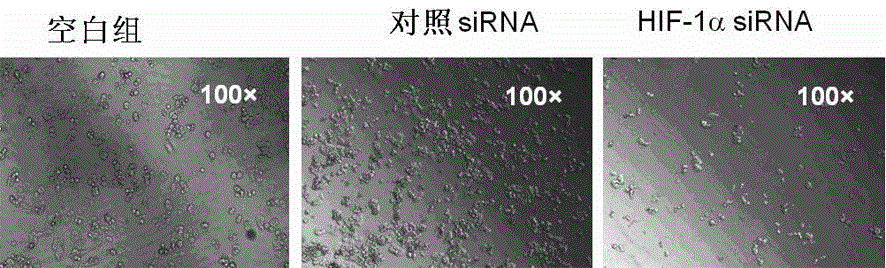 AmiRNA-HIF-1alpha sequence containing recombinant plasmid