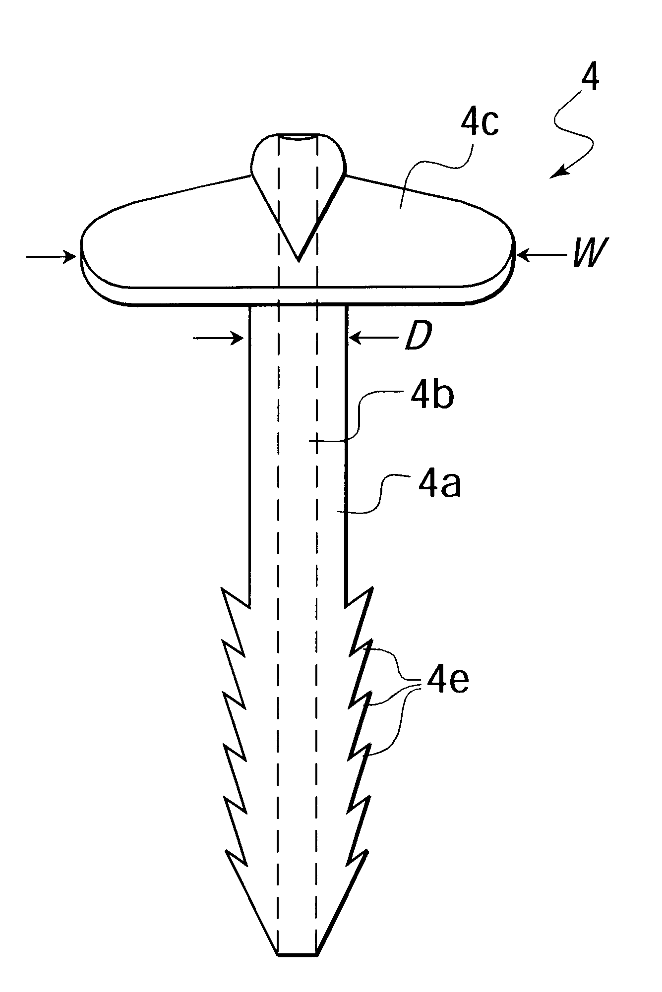 Anatomical fixation implant