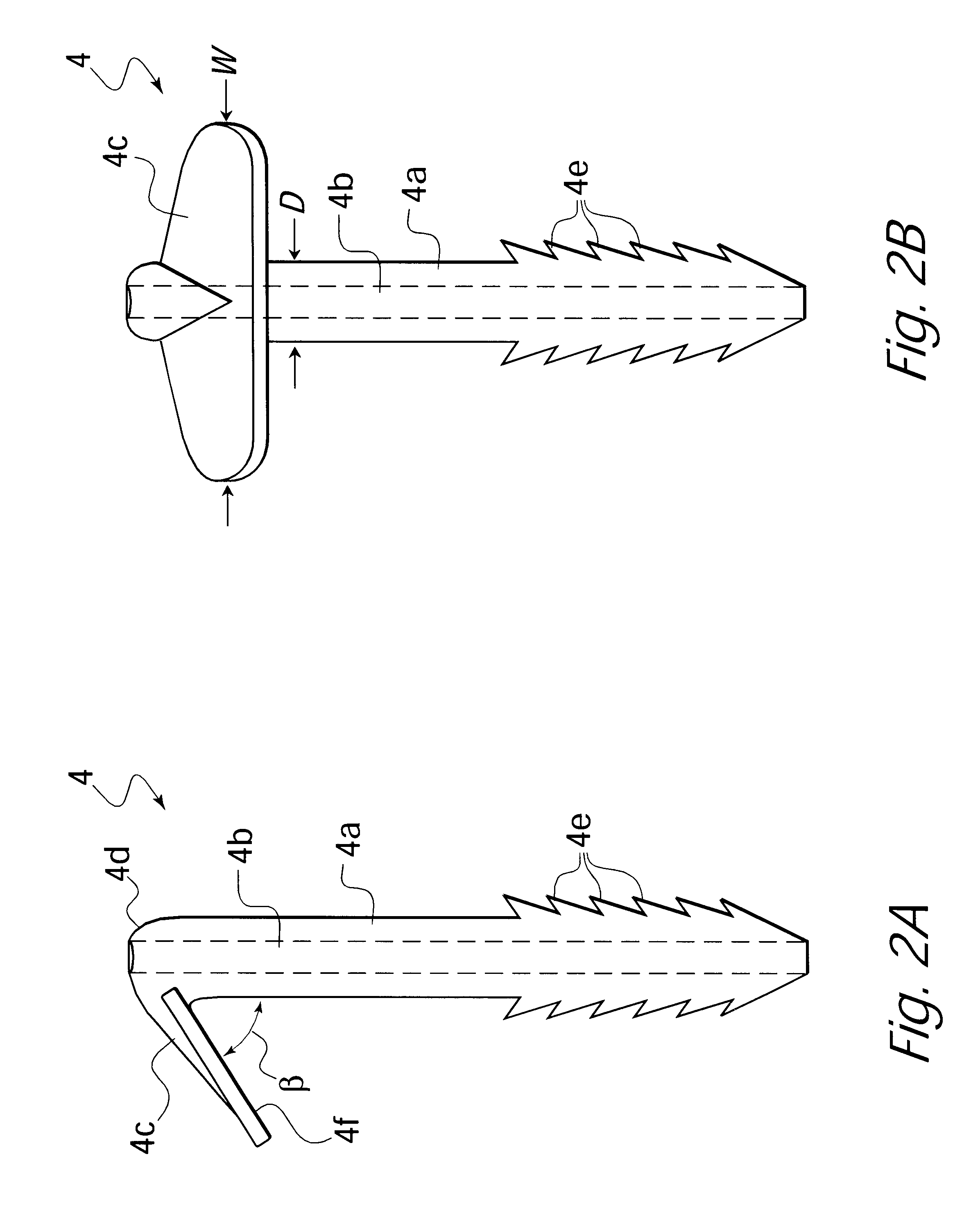 Anatomical fixation implant