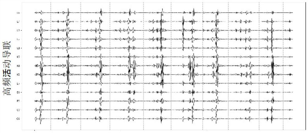 Electroencephalogram activity identification method and device, electronic equipment and medium