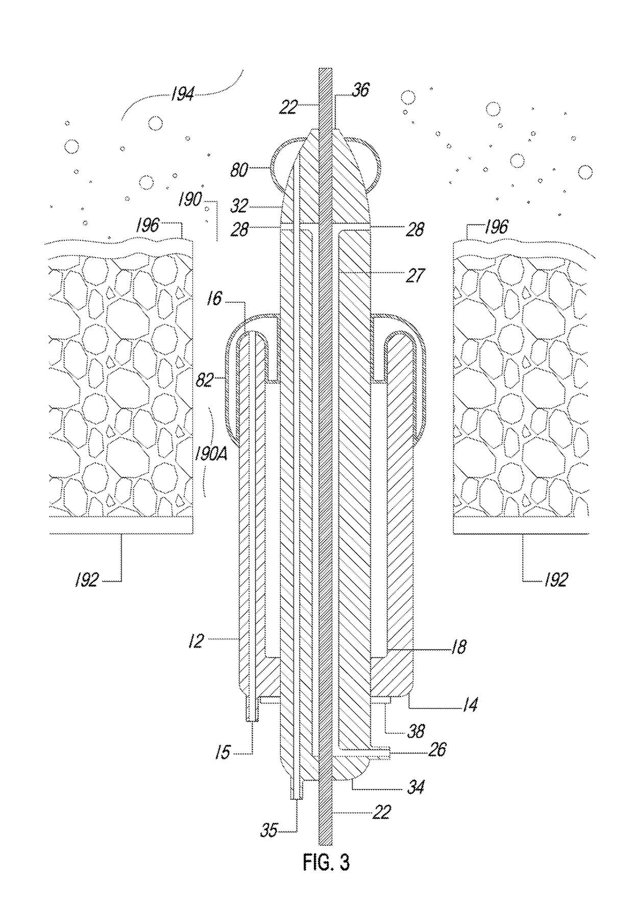 Balloon Closure Device