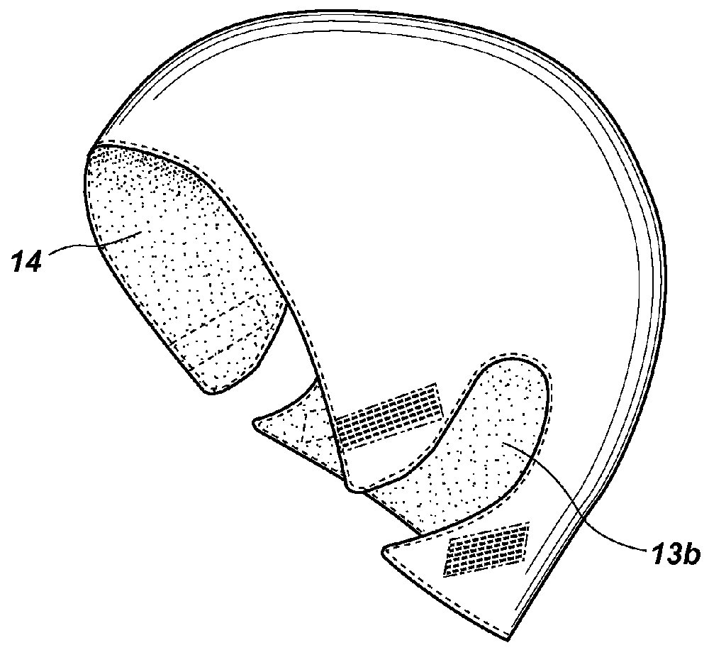 Head trauma bandage cap and method