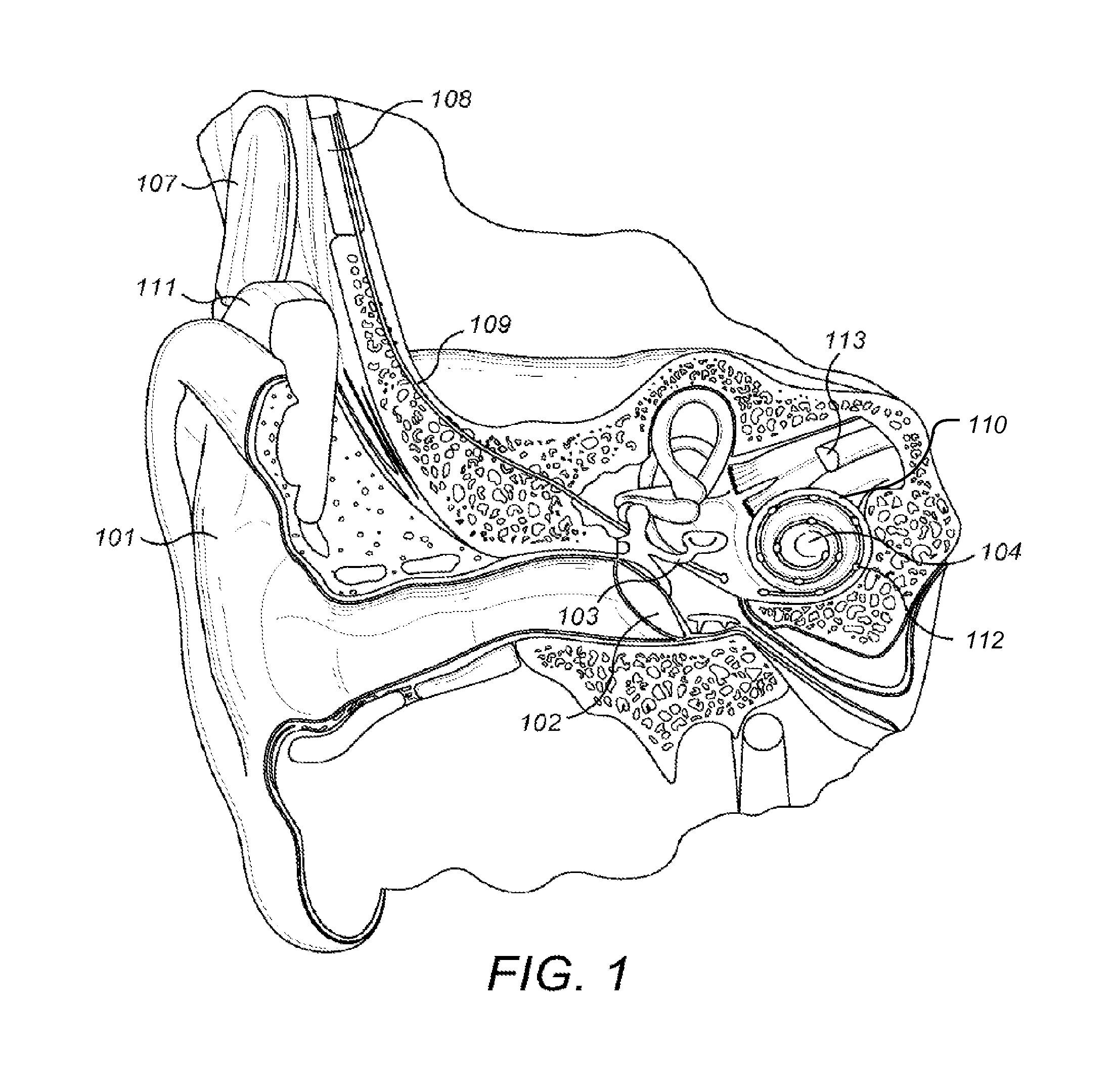 Auditory Prosthesis Using Stimulation Rate as a Multiple of Periodicity of Sensed Sound