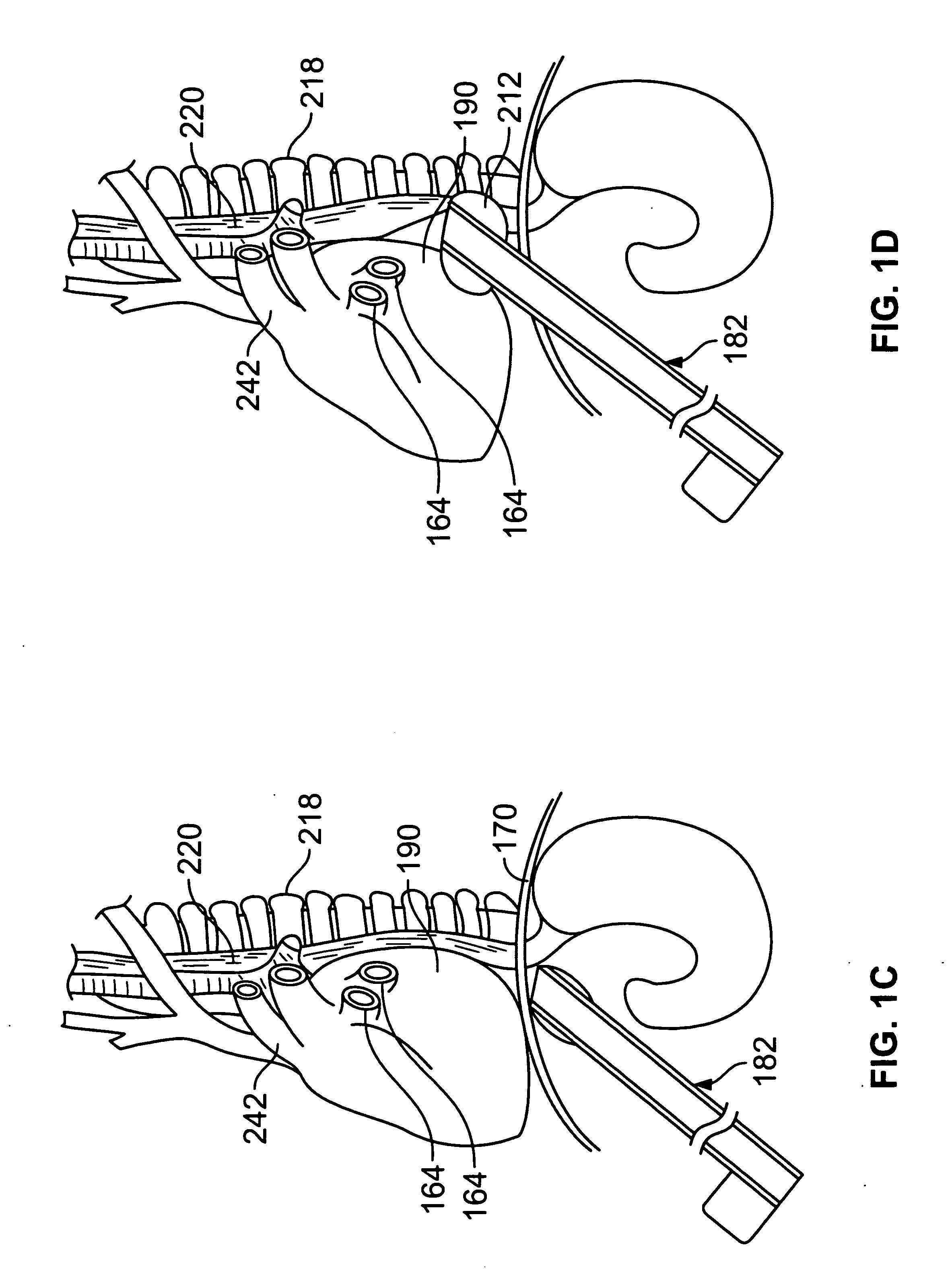 Diaphragm entry for posterior surgical access