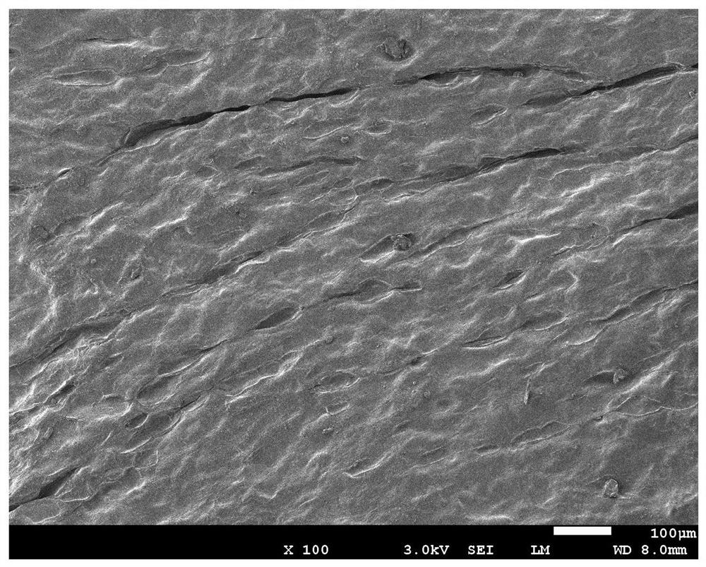 Acellular dermal matrix-guided tissue regeneration membrane material and its preparation method and application