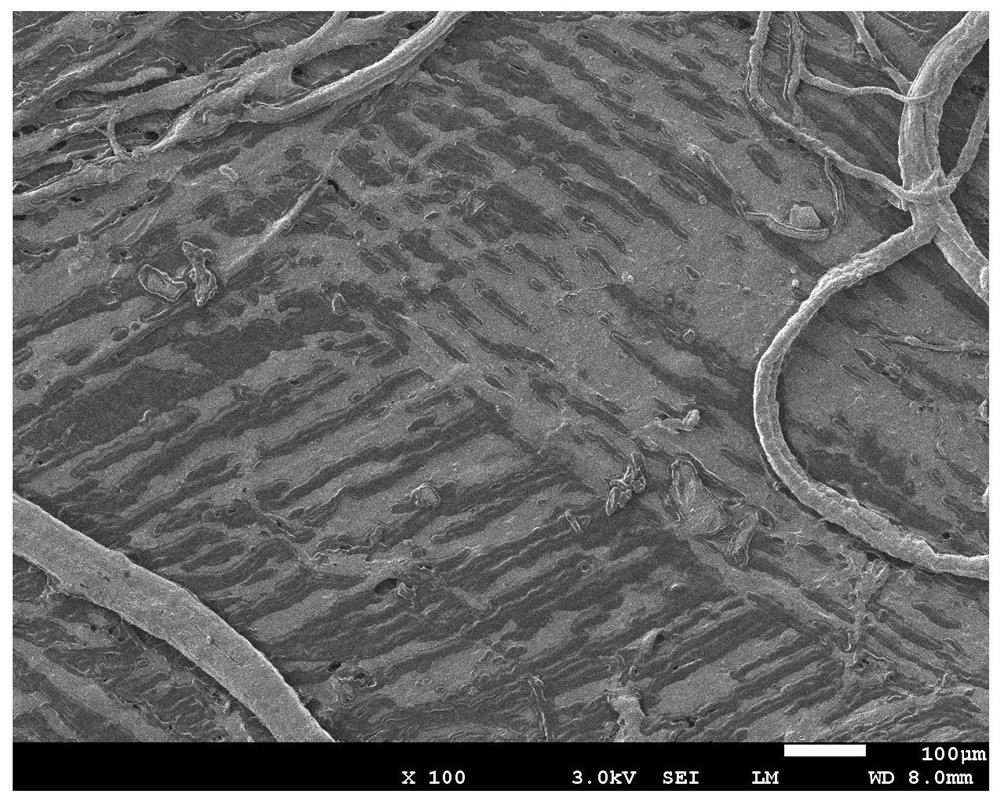 Acellular dermal matrix-guided tissue regeneration membrane material and its preparation method and application