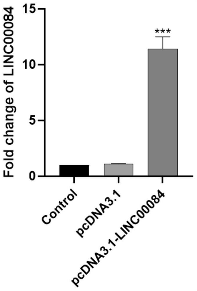 Application of linc00084 in the preparation of adjuvant drugs for hypoxic tumor radiotherapy