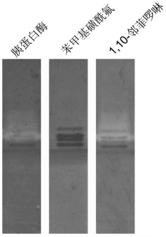 Application of protease graph electrophoresis detection method to rapid identification of extracellaluar protease variety of bacteria