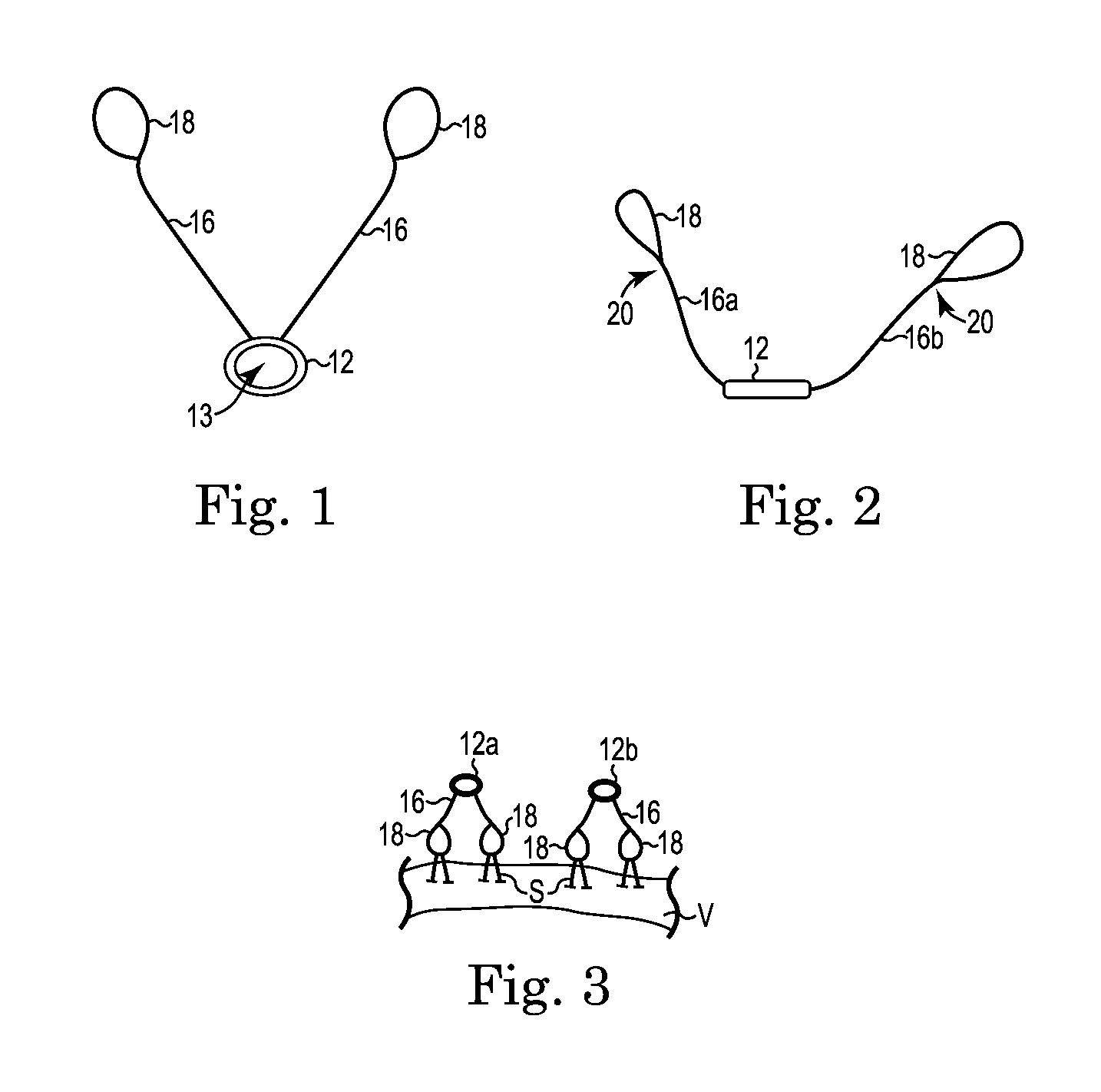 Vaginal vault suspension system and method