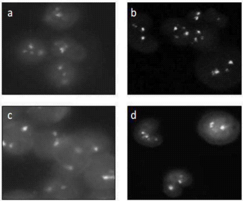 Probe set, kit and method for rapid detection of BCR/ABL gene fusion