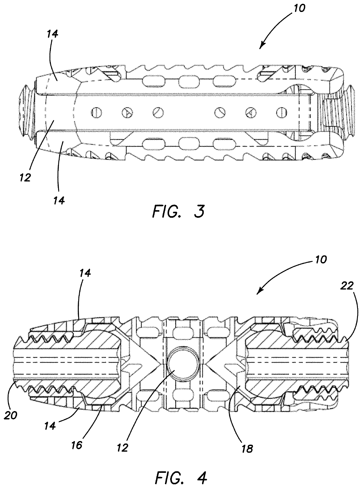 Expandable interbody spacer