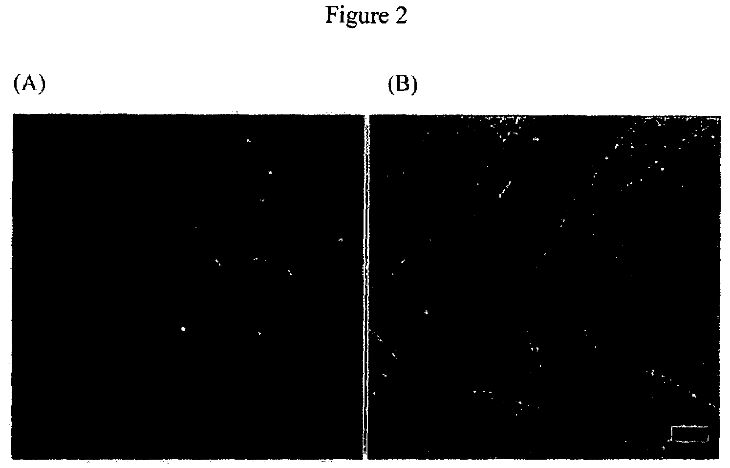 Viral fibers