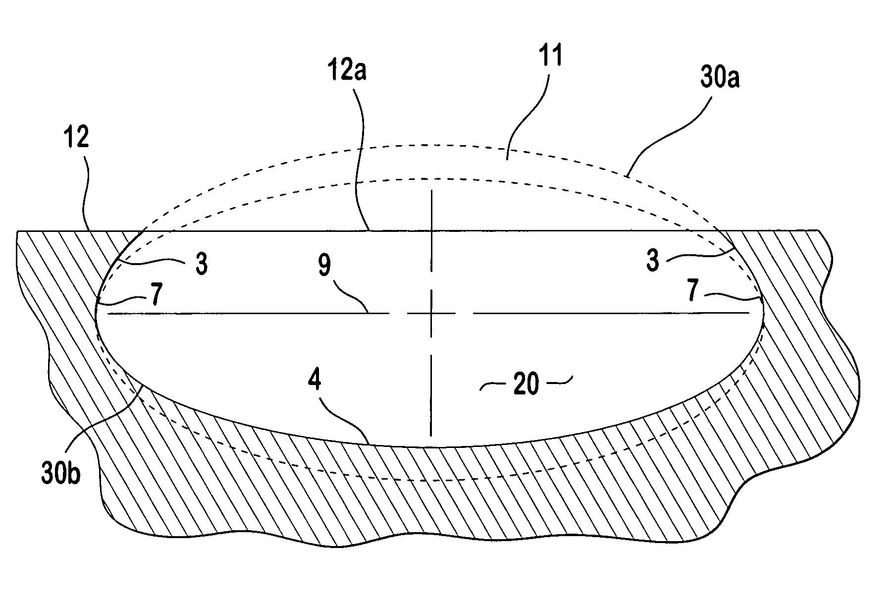 Textured surface having undercut micro recesses in a surface