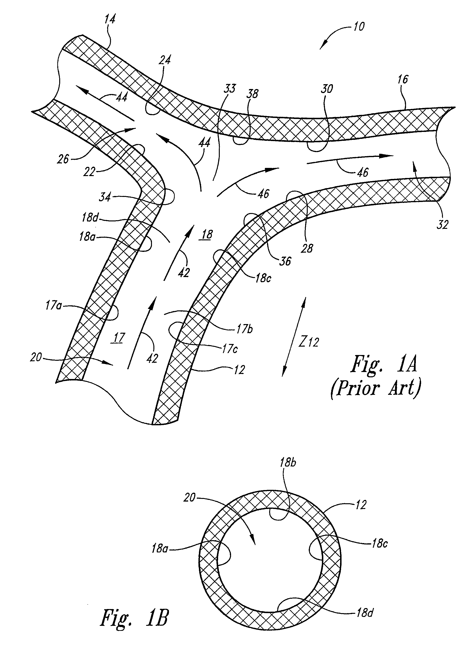 Vascular anchoring system and method