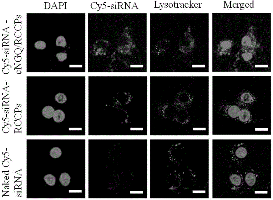 Reversibly crosslinked biodegradable polymersome with asymmetric membrane structure as well as preparation method and application thereof to nucleic acid medicines