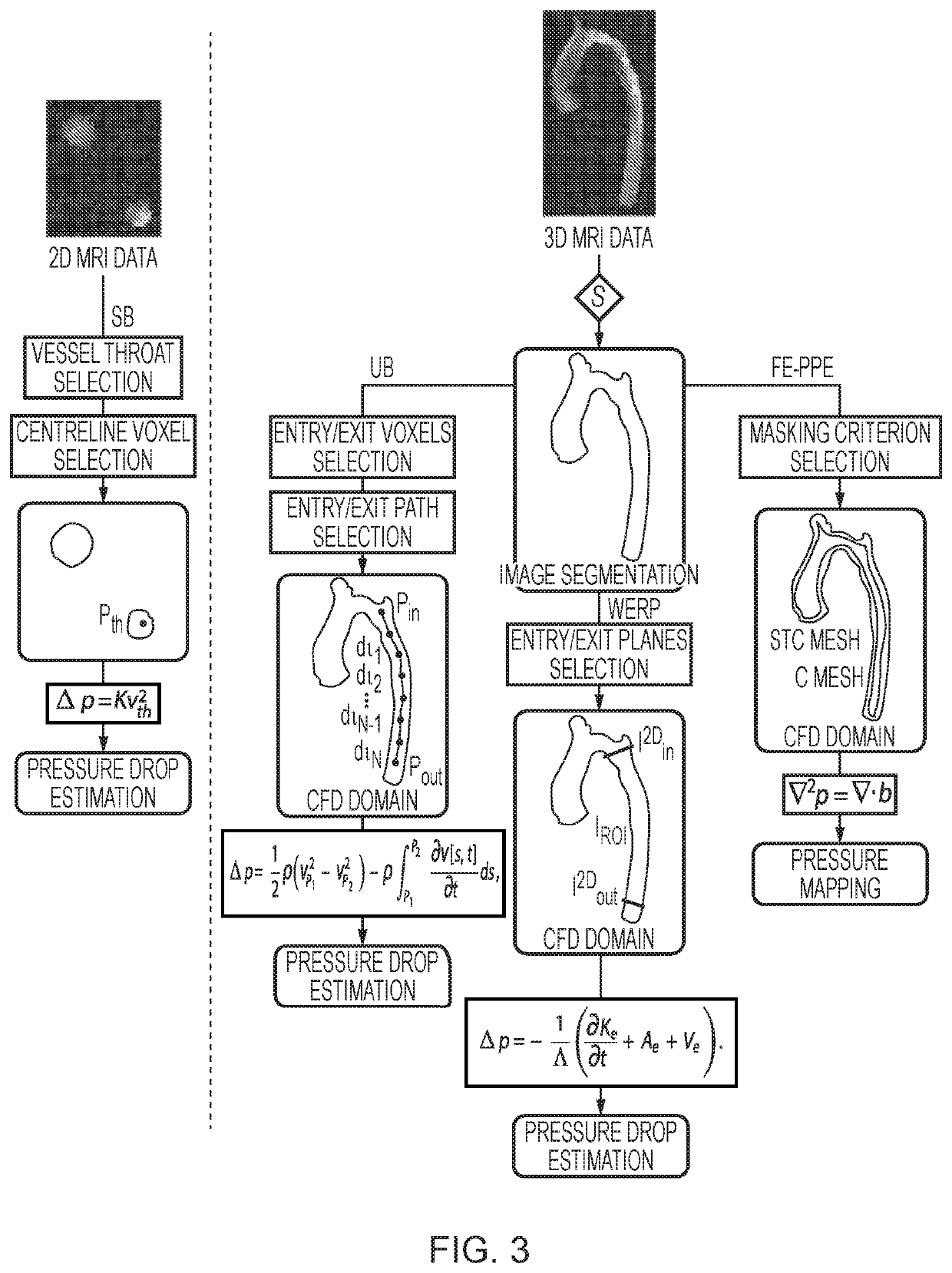 Method and system for pressure drop estimation