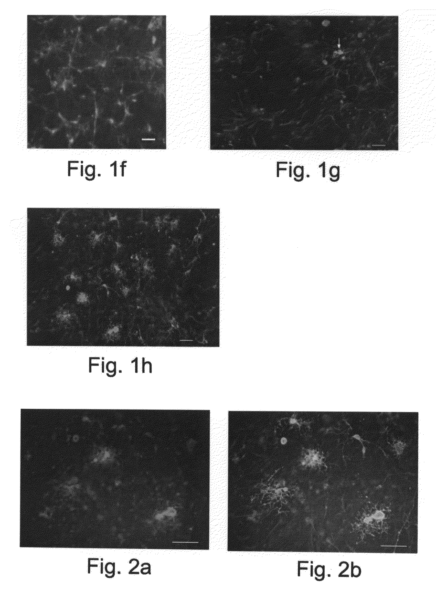 Methods of generating glial and neuronal cells and use of same for the treatment of medical conditions of the cns