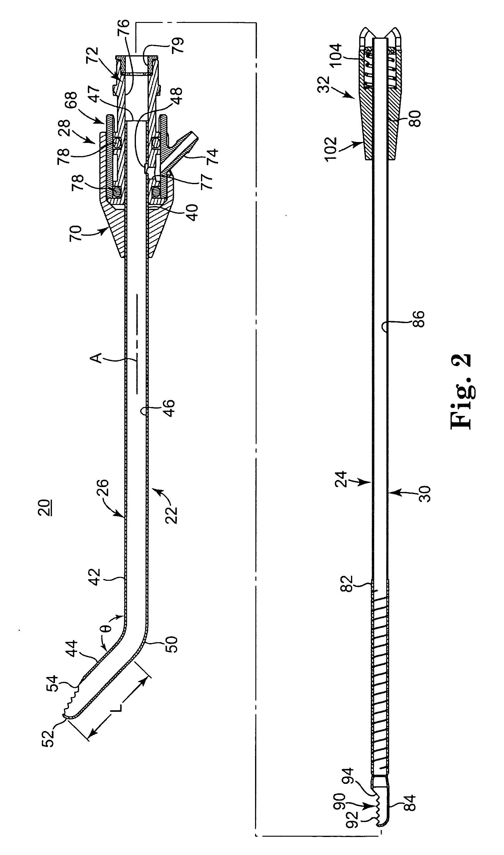 Method and apparatus for removing material from an intervertebral disc space, such as in performing a nucleotomy