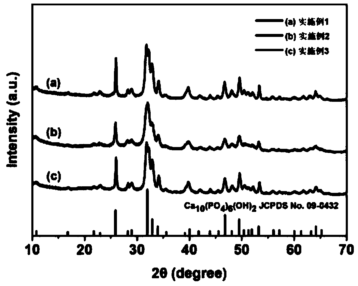 Aminoized hydroxyapatite/chitosan composite aerogel as well as preparation method and application thereof