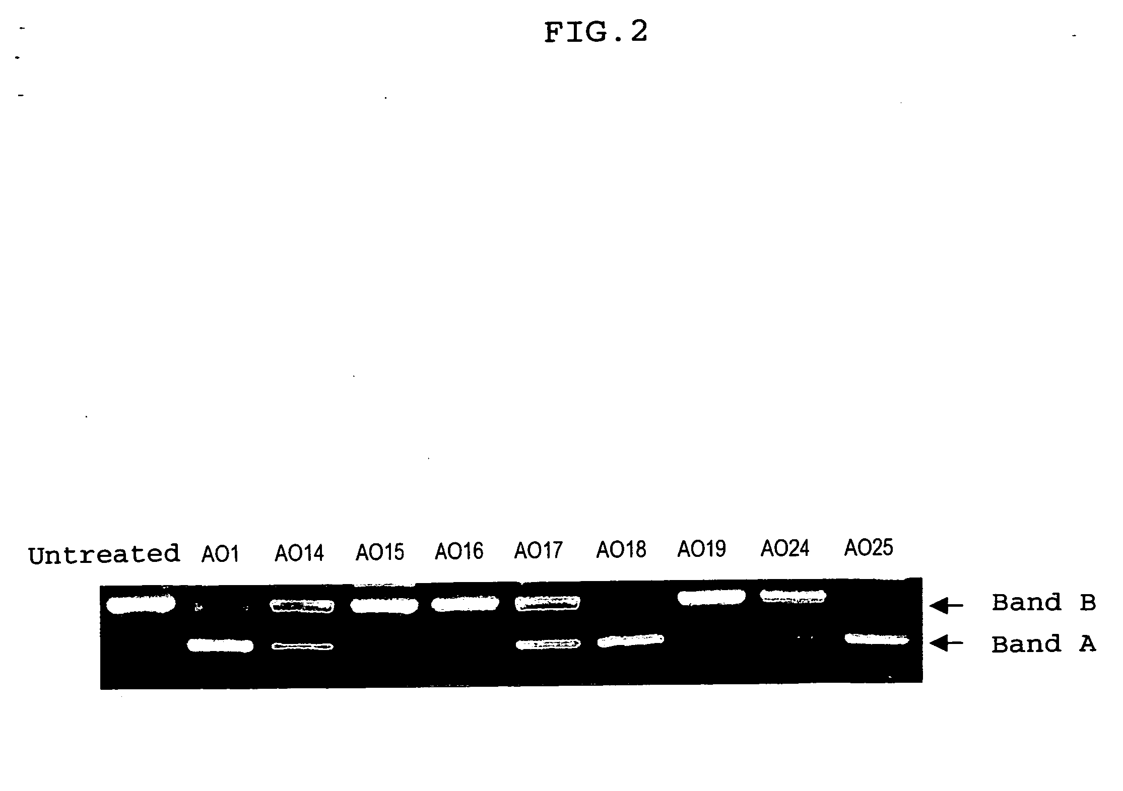 Ena nucleic acid drugs modifying splicing in mrna precursor