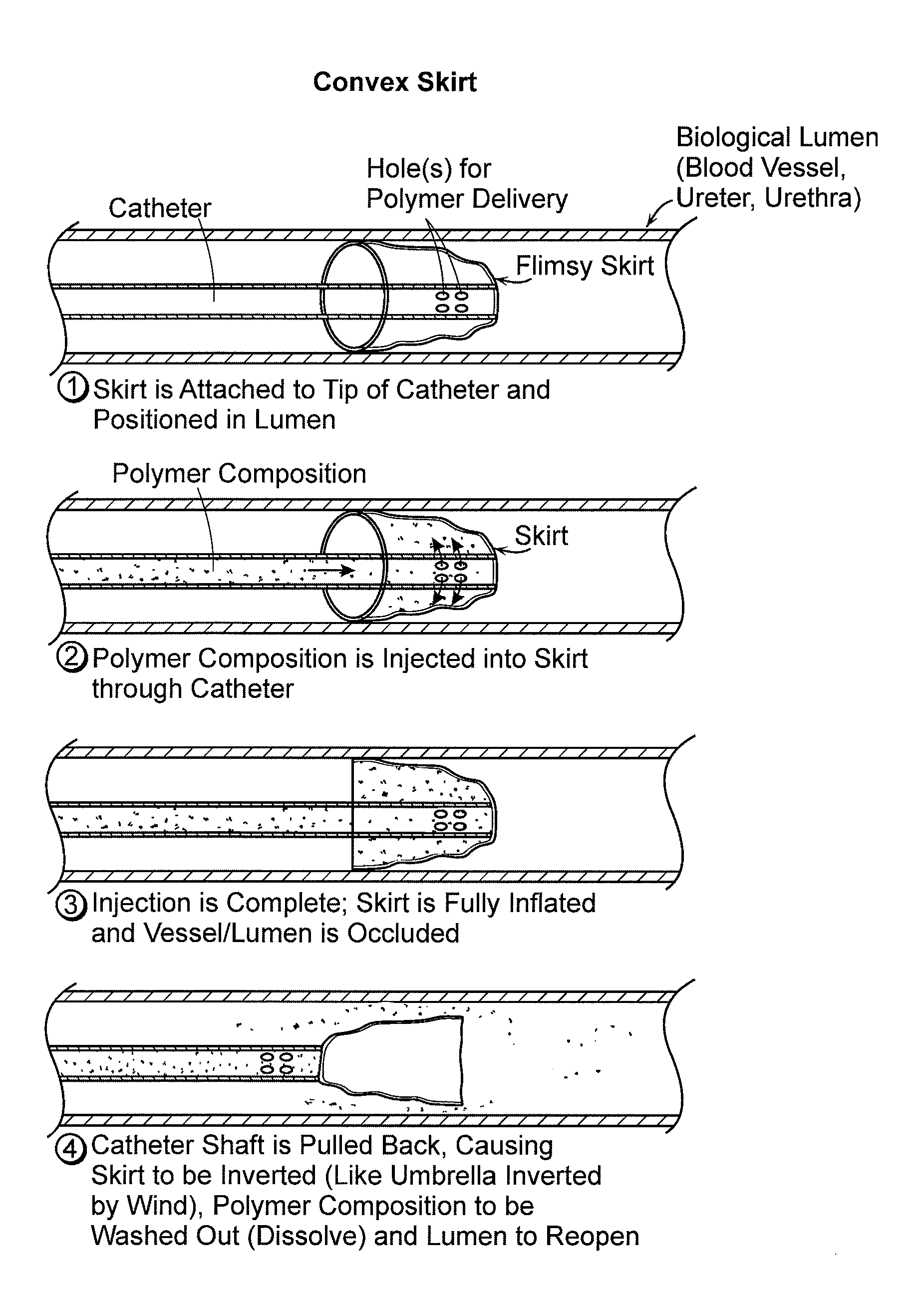 Atraumatic Occlusion Balloons and Skirts, and Methods of Use Thereof