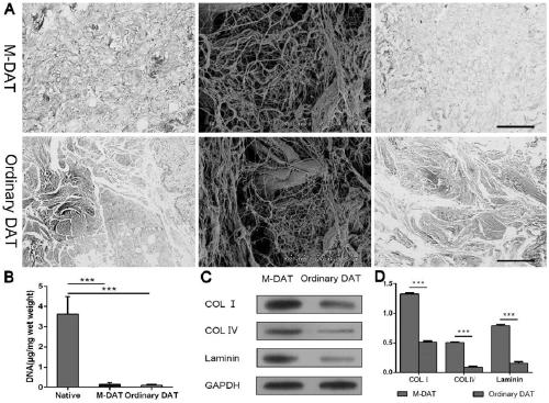 Fat extract, fat acellular matrix and preparation method and application of fat acellular matrix