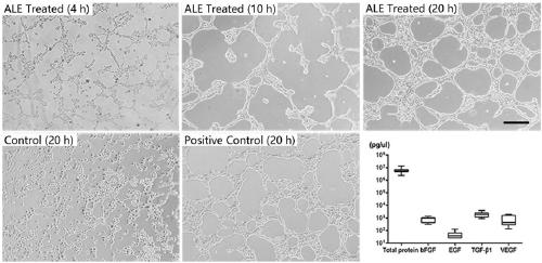 Fat extract, fat acellular matrix and preparation method and application of fat acellular matrix