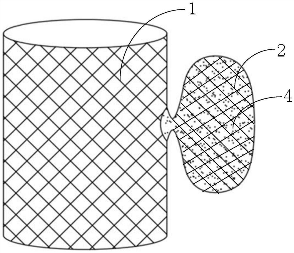 Aortic dissection crevasse plugging device