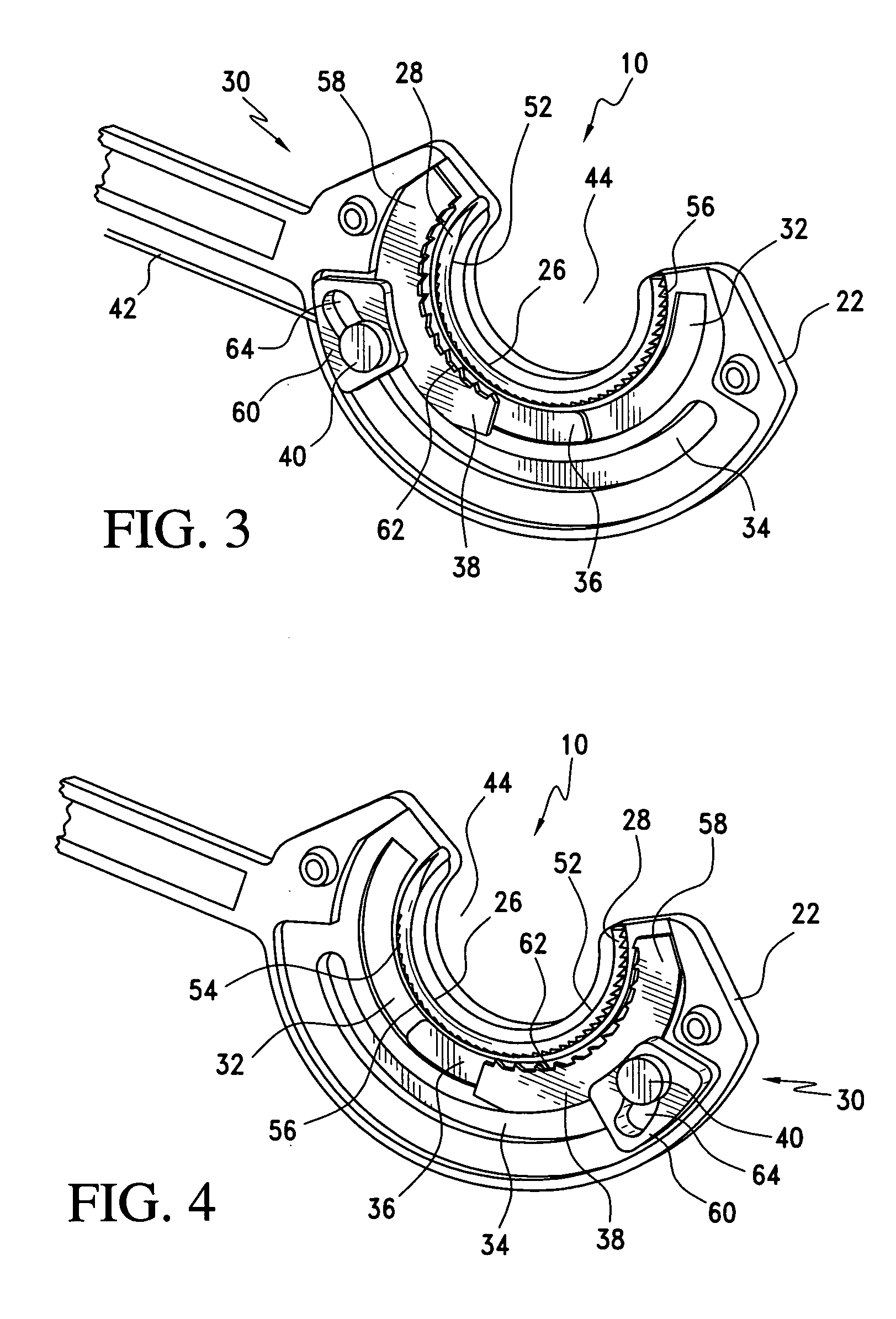 Method for suture lacing