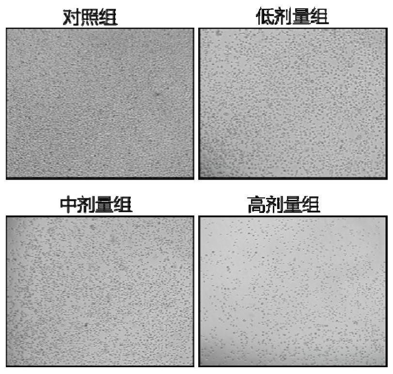 Pharmaceutical composition for treating lung cancer and application thereof