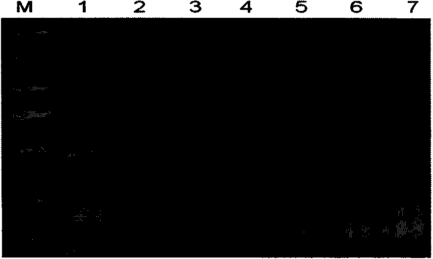 Method for detecting turnip mosaic virus by adopting reverse transcription loop-mediated isothermal amplification technology