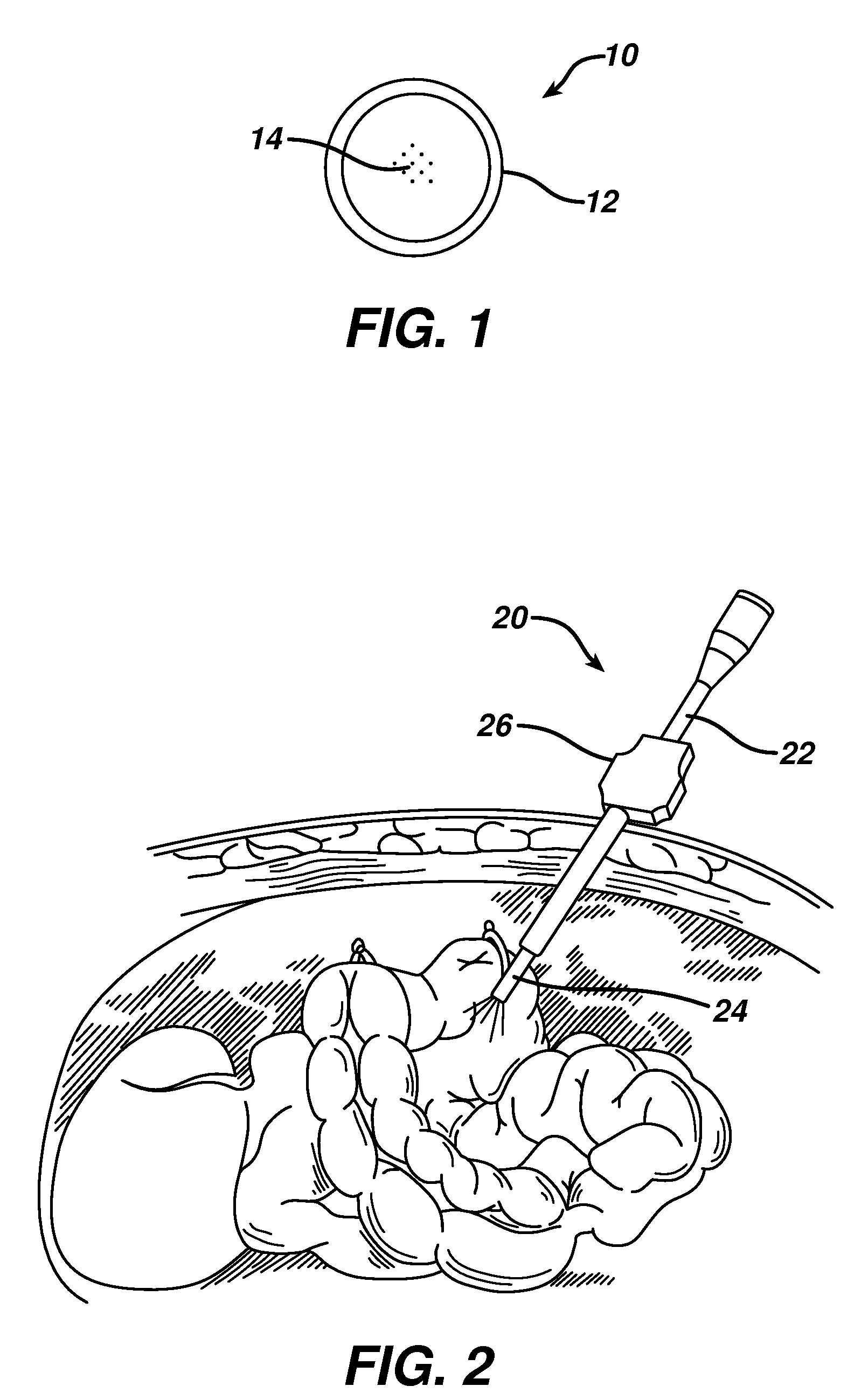 Magnetic nanoparticle therapies