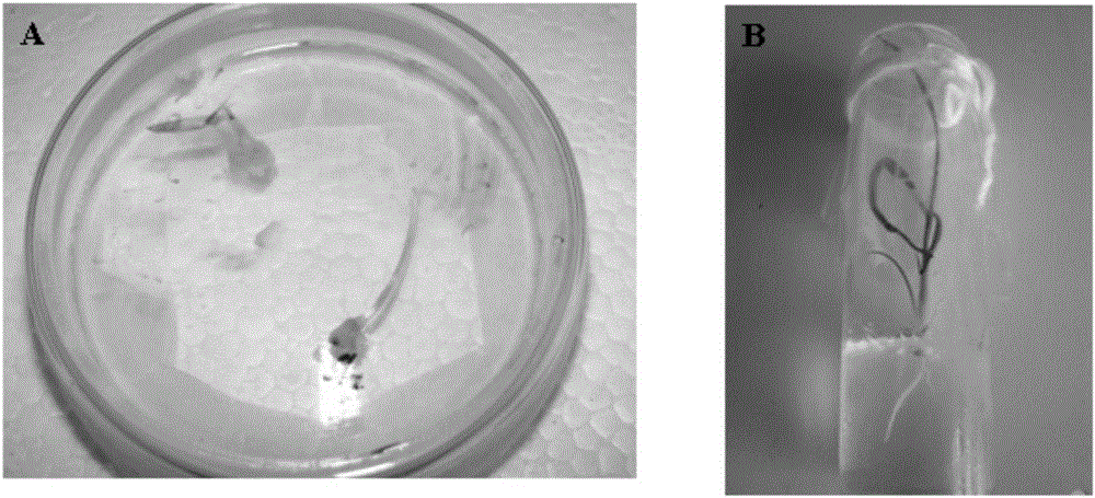 Tissue culture method of young barley embryos directly into seedlings and the medium used