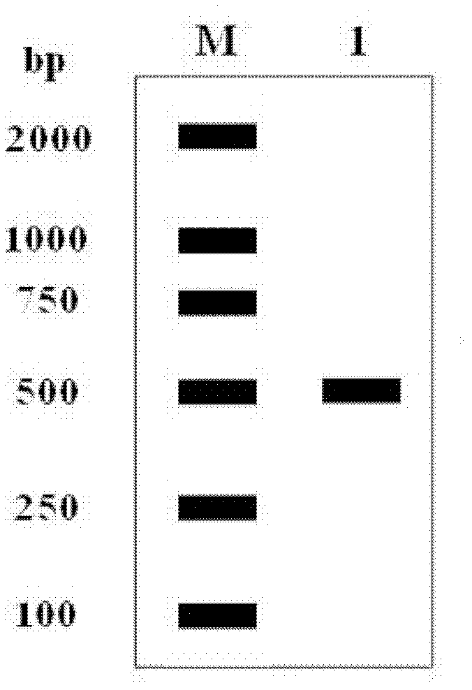 Preparation method for recombinant human interferon alpha-2b free of methionine