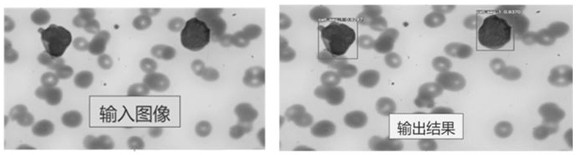 White blood cell detection and identification method, device, computer storage medium and electronic equipment