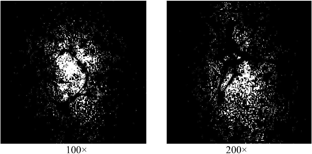 Induction culture medium and induction method for differentiating umbilical stalk mesenchymal stem cells into neuron-like cells