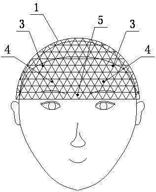 Intelligent acupuncture and moxibustion diagnosis and treatment instrument for treating migraine