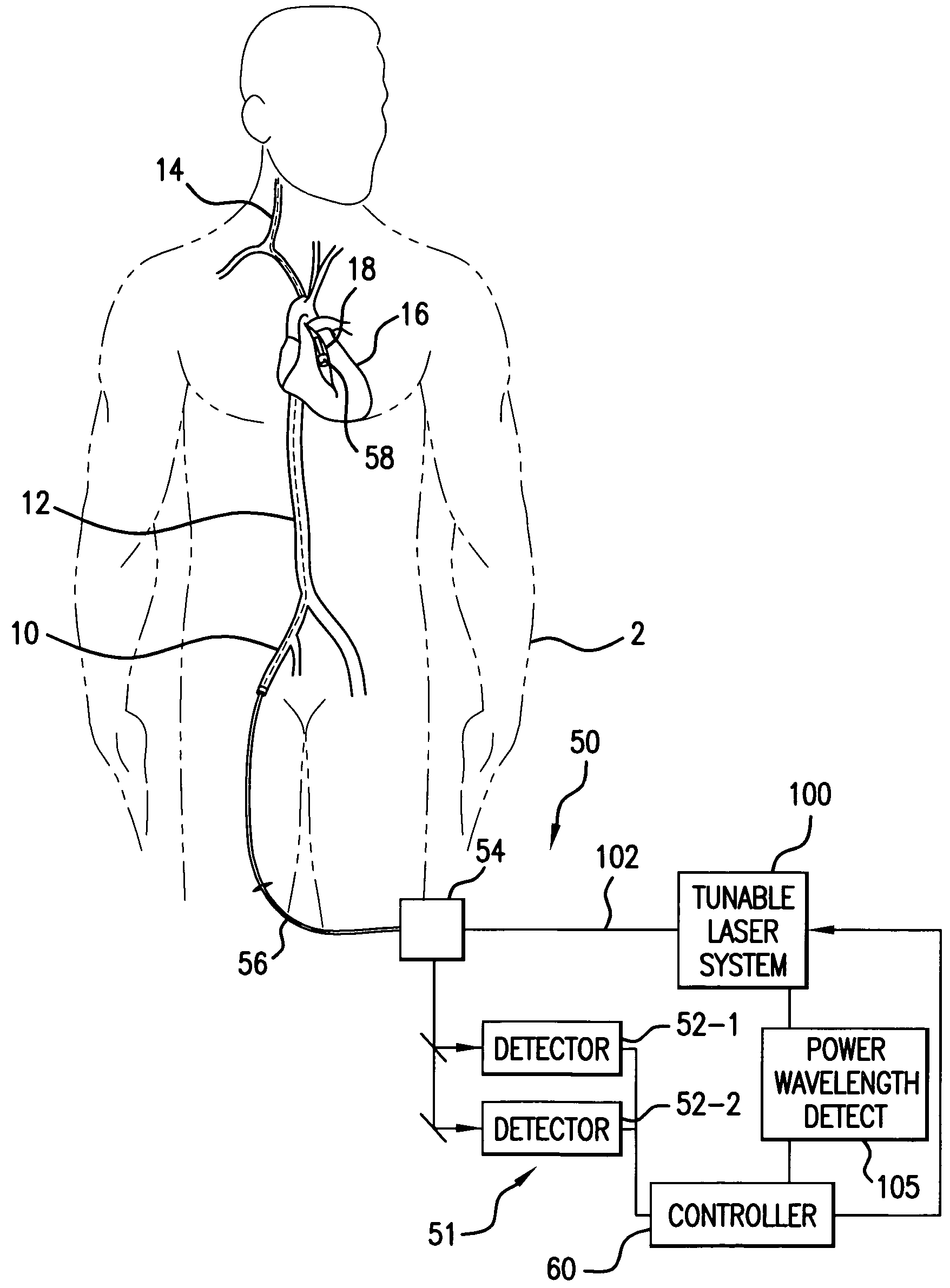 Spectroscopic catheter system with widely tunable source and method of operation