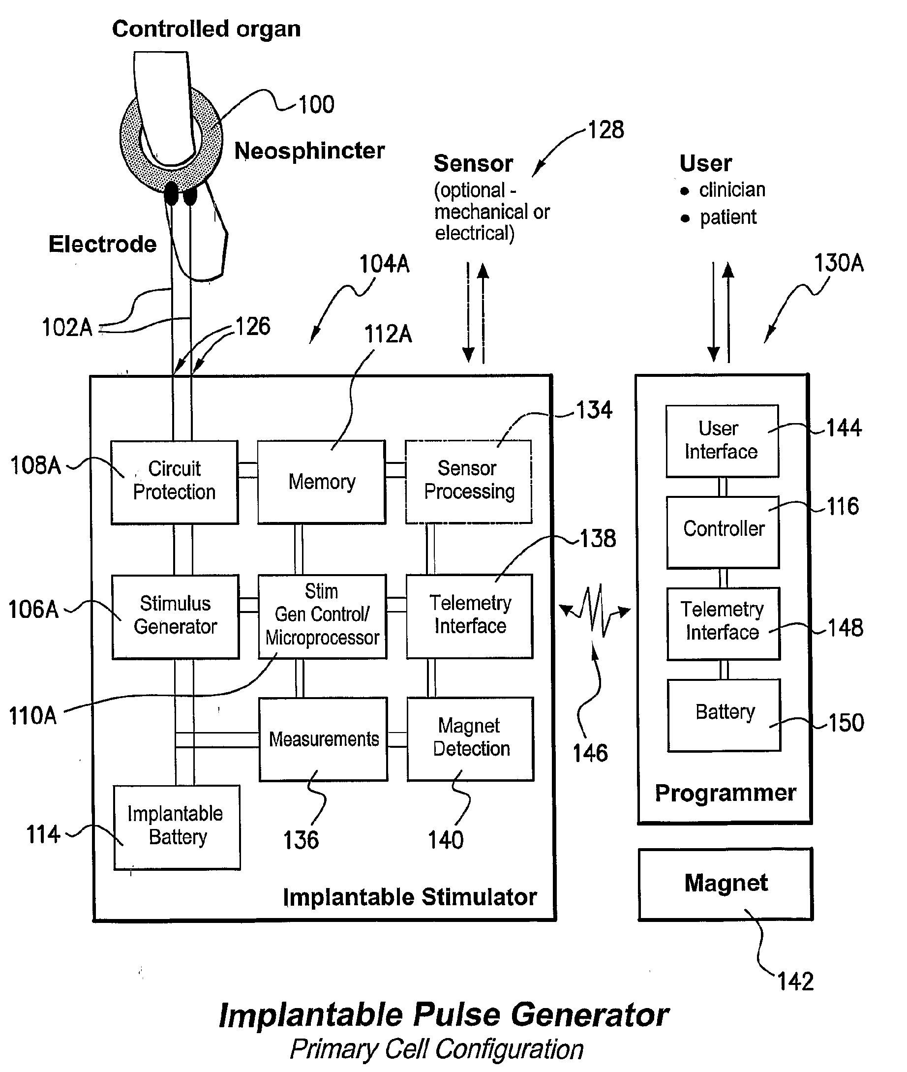 Stimulator For The Control of a Bodily Function