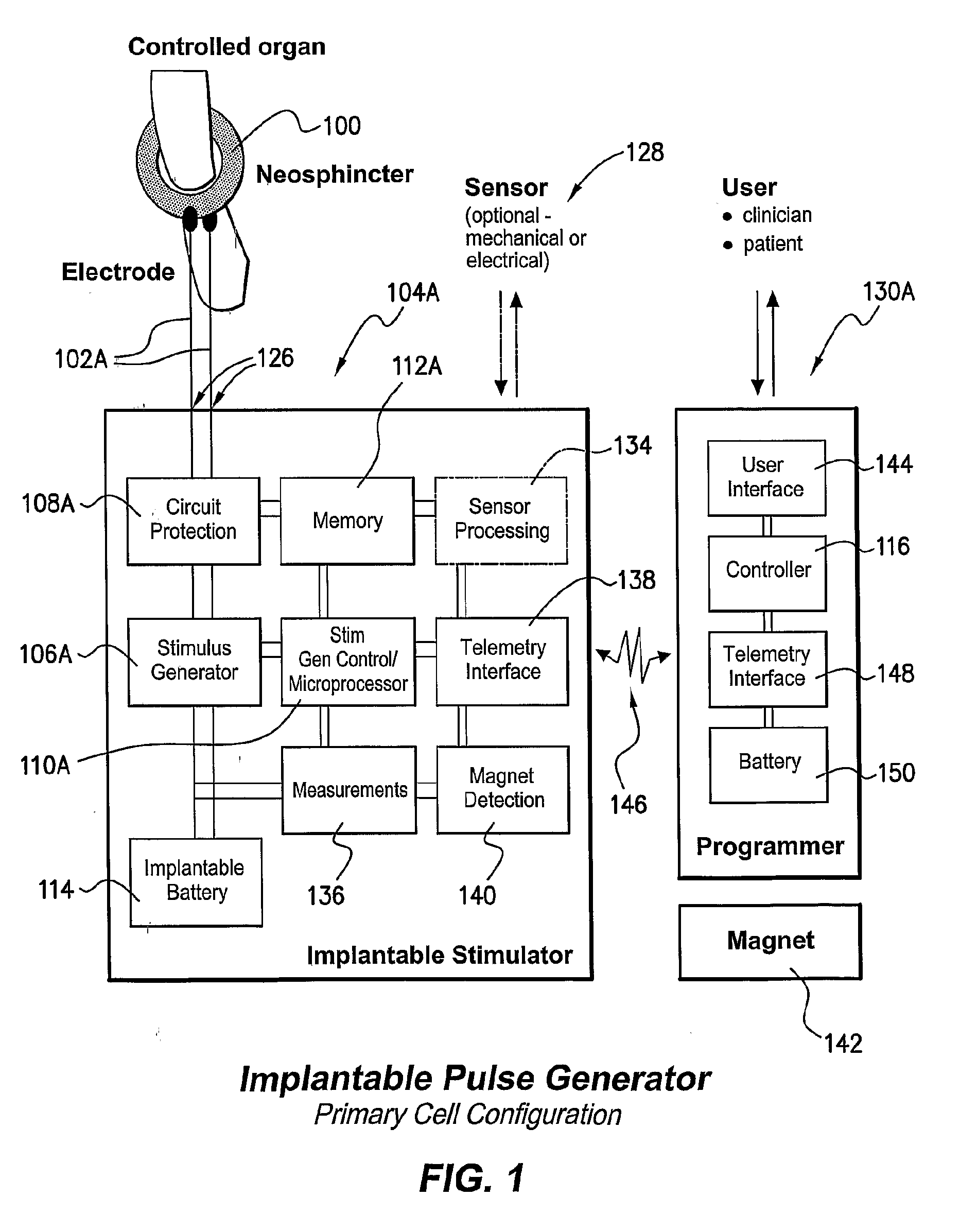 Stimulator For The Control of a Bodily Function