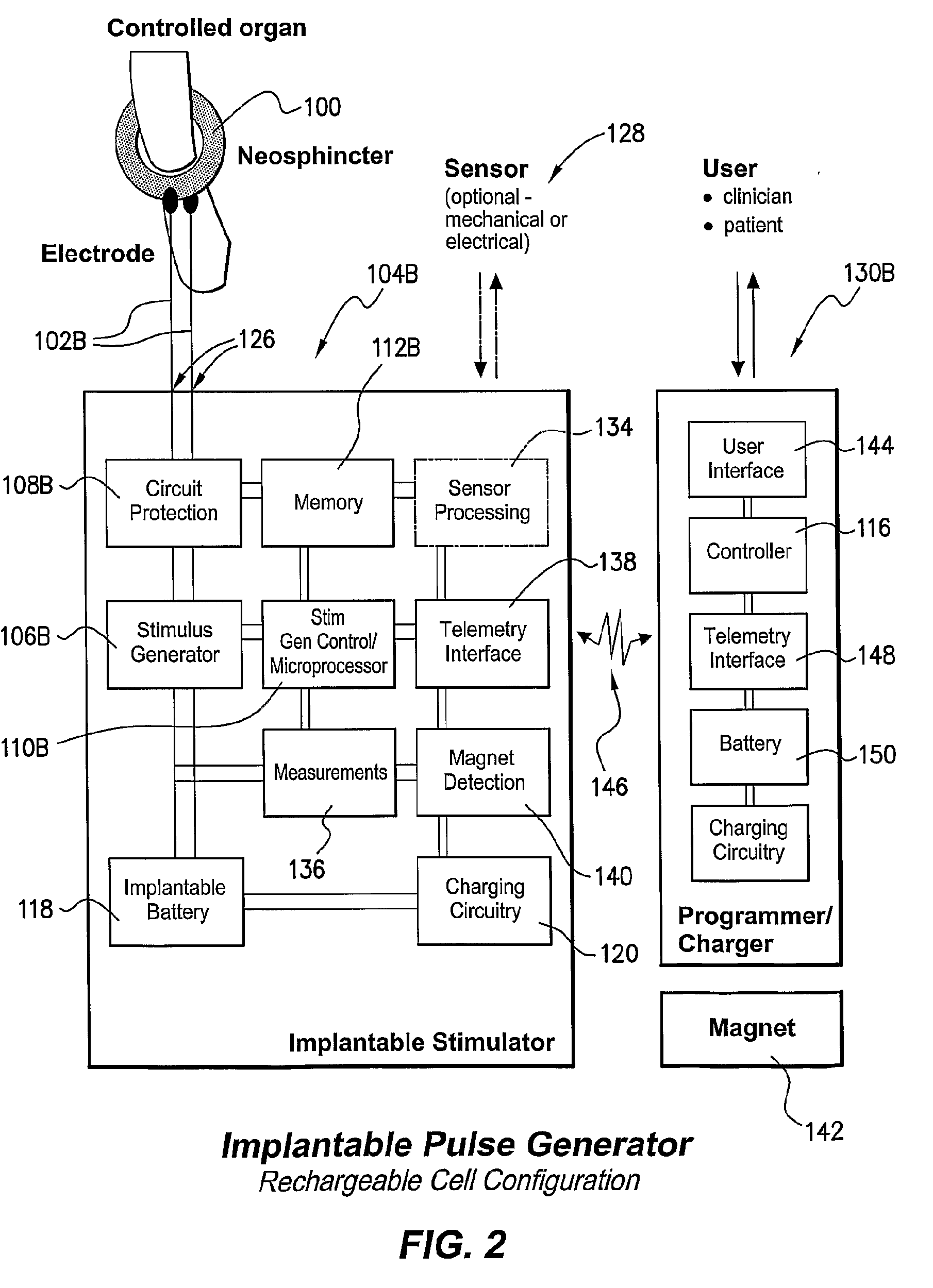 Stimulator For The Control of a Bodily Function