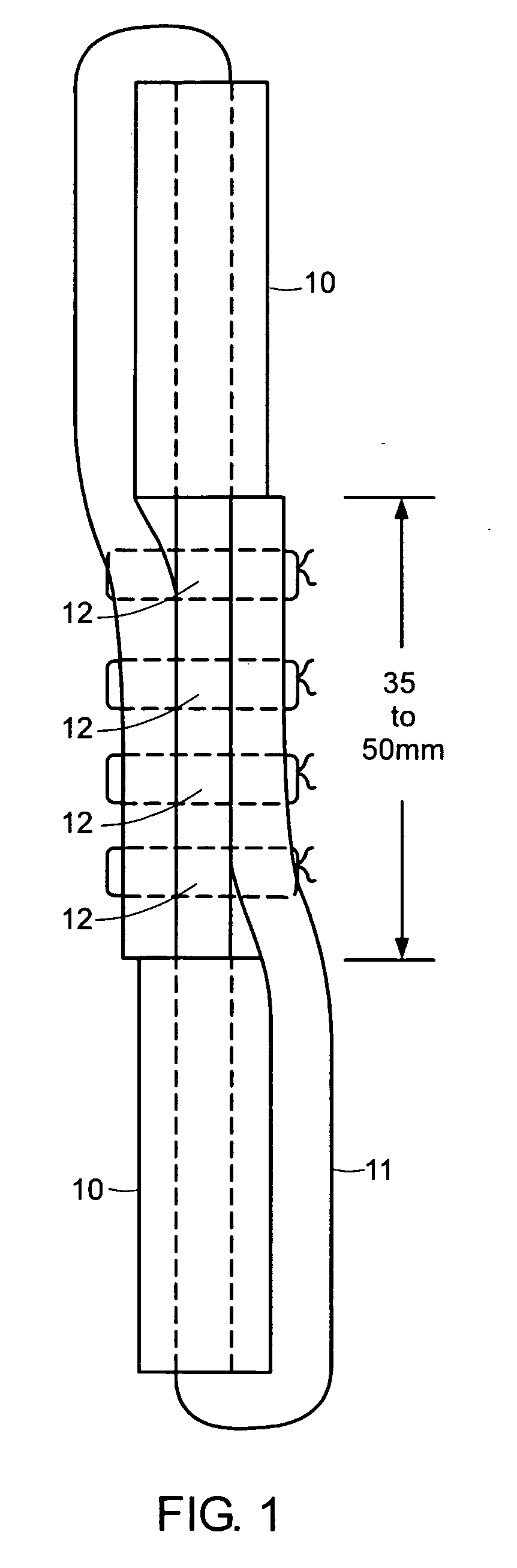 Bioabsorbable fasteners for preparing and securing ligament replacement grafts