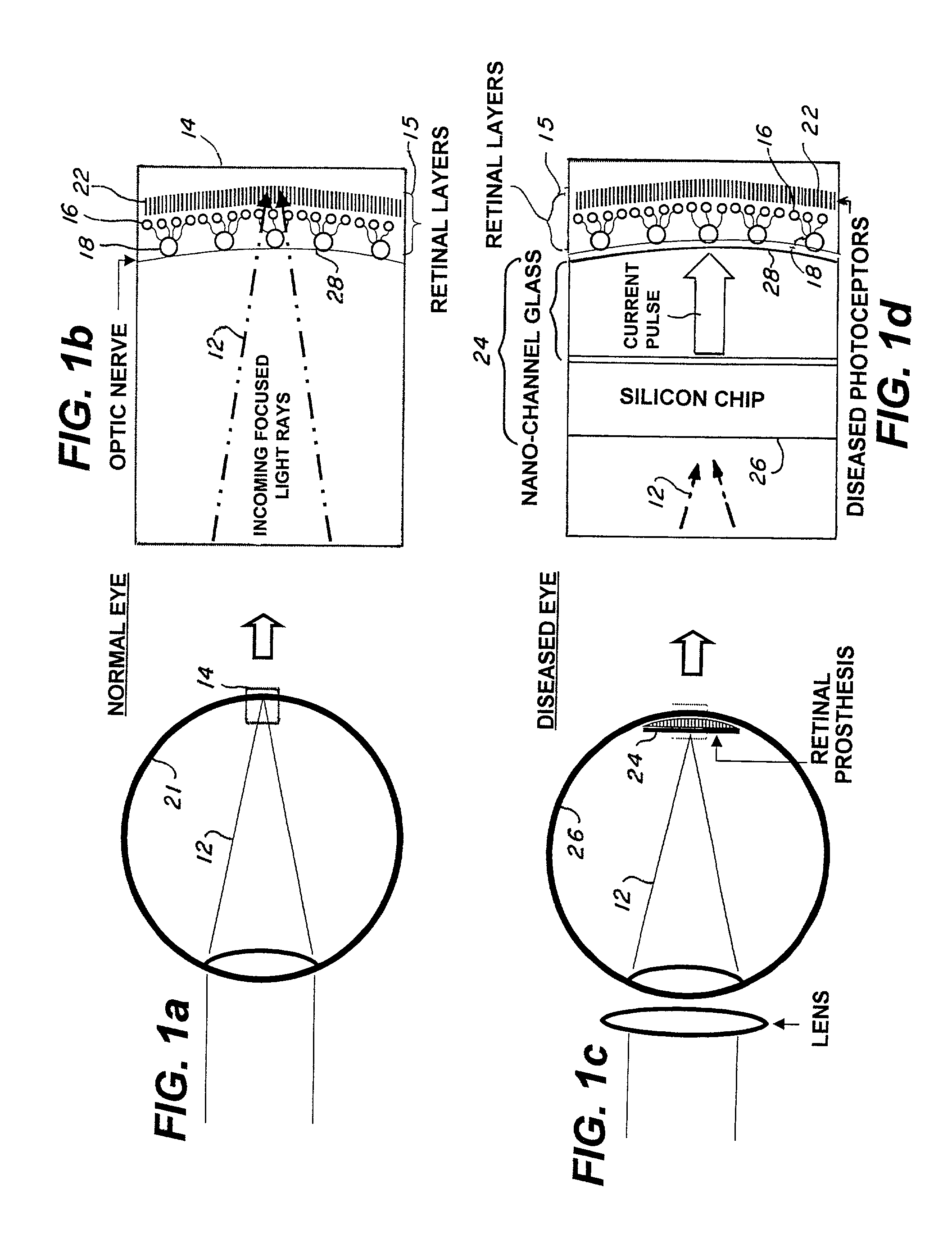 Microelectronic stimulator array for stimulating nerve tissue