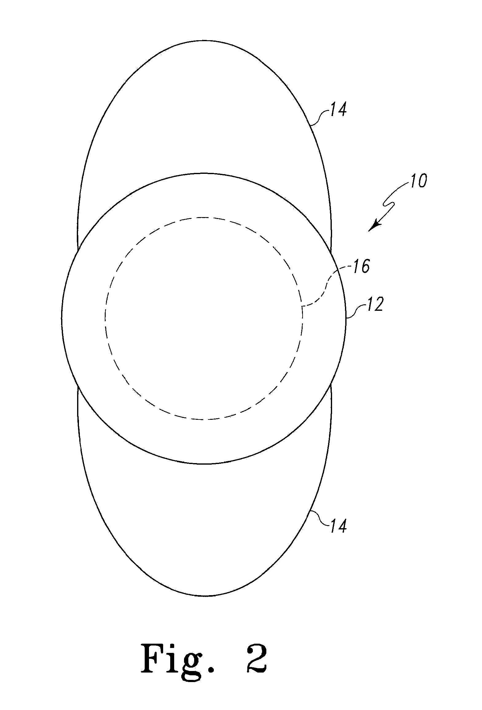 Interfacial refraction accommodating lens (IRAL)