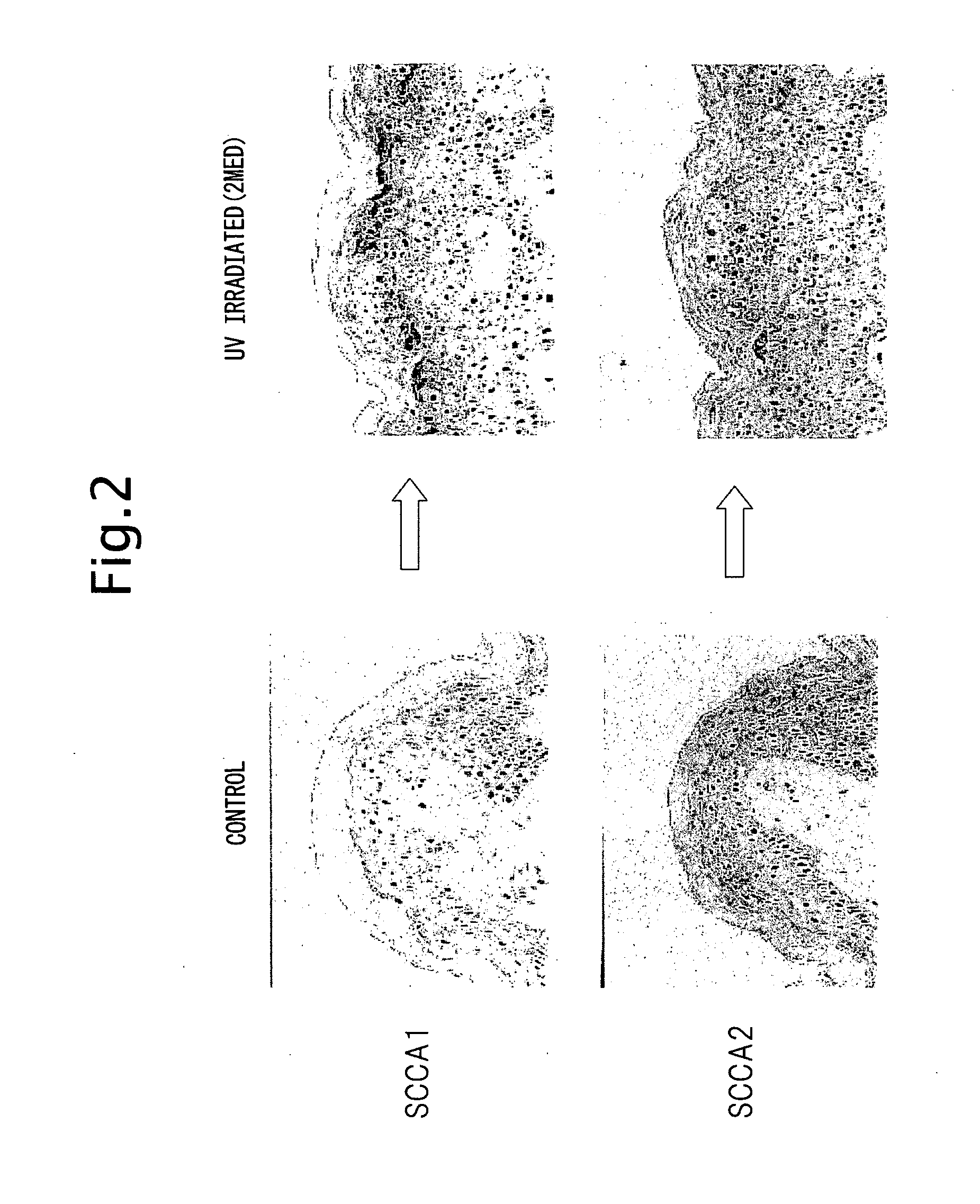 Method for reducing ultraviolet light induced apoptosis