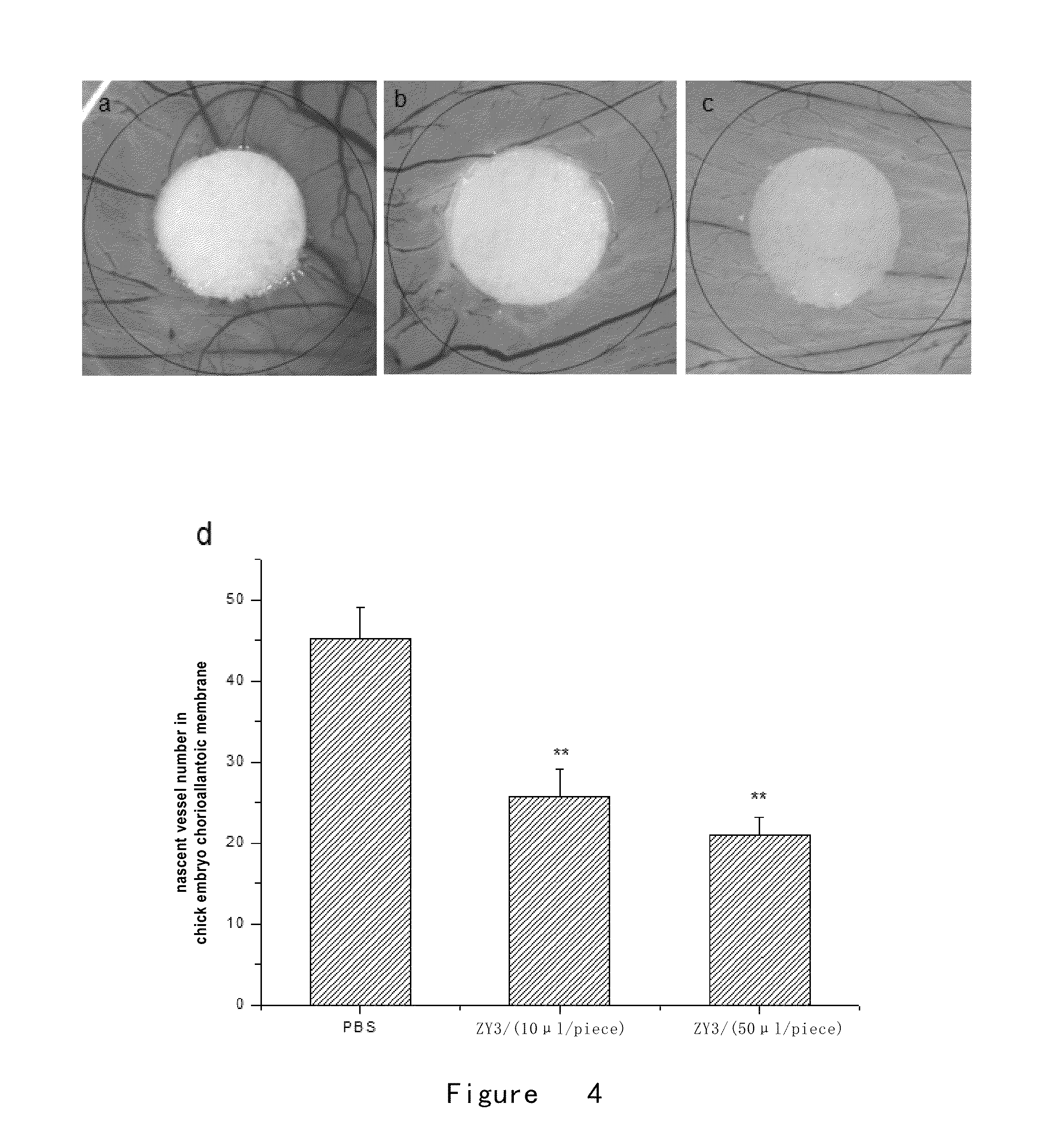 Polypeptides inhibiting neovascularization and uses thereof