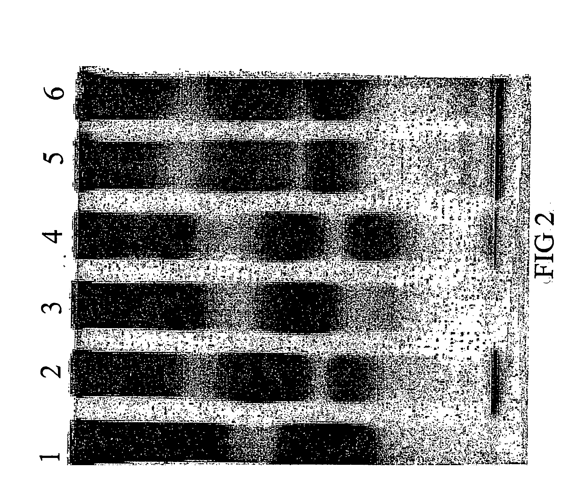 Composite peptide compounds for diagnosis and treatment of diseases caused by prion proteins