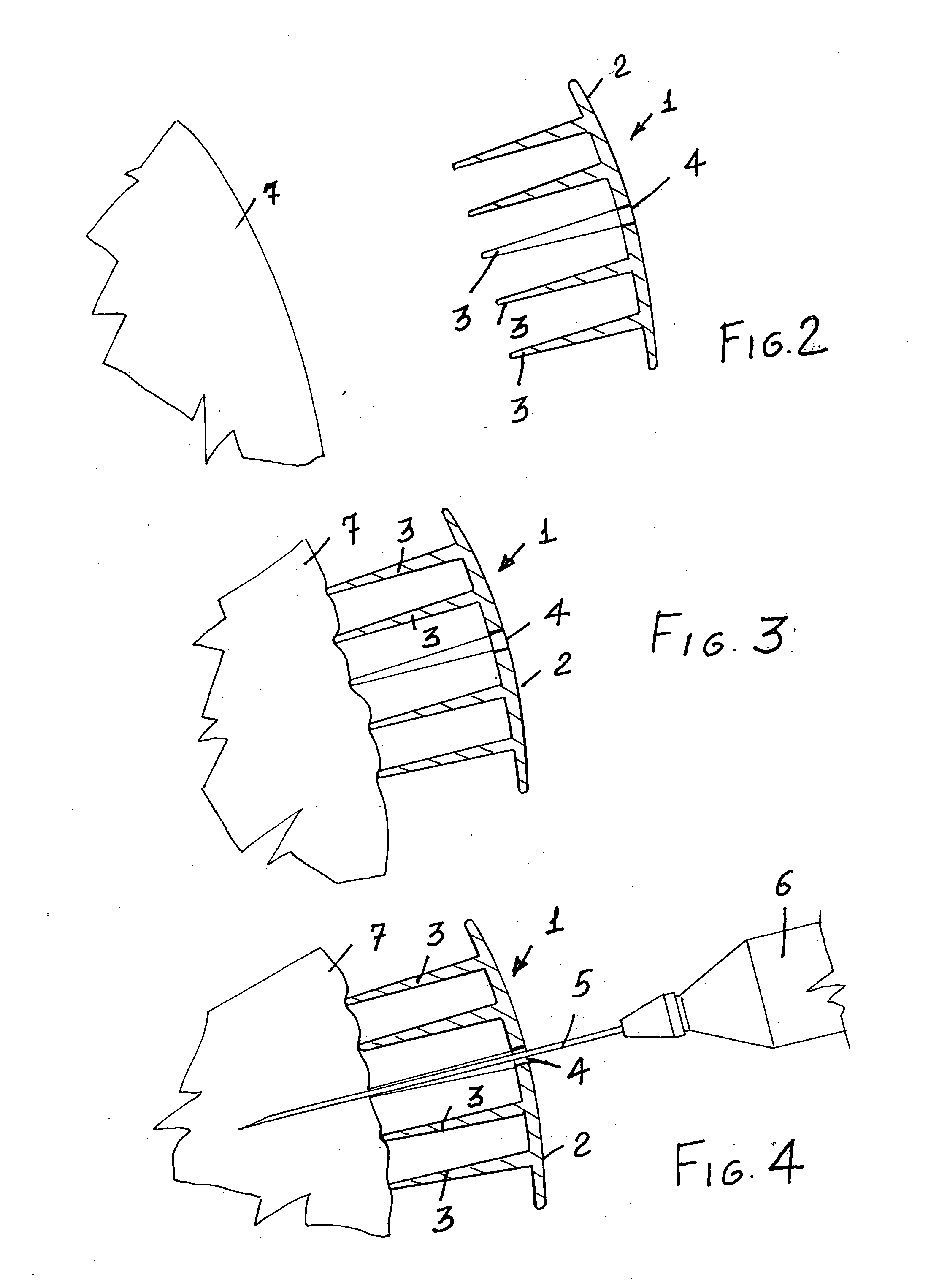 Auxiliary device for attenuating pain of injections, traumas, small lesions, hair removing operations, and inflammation conditions