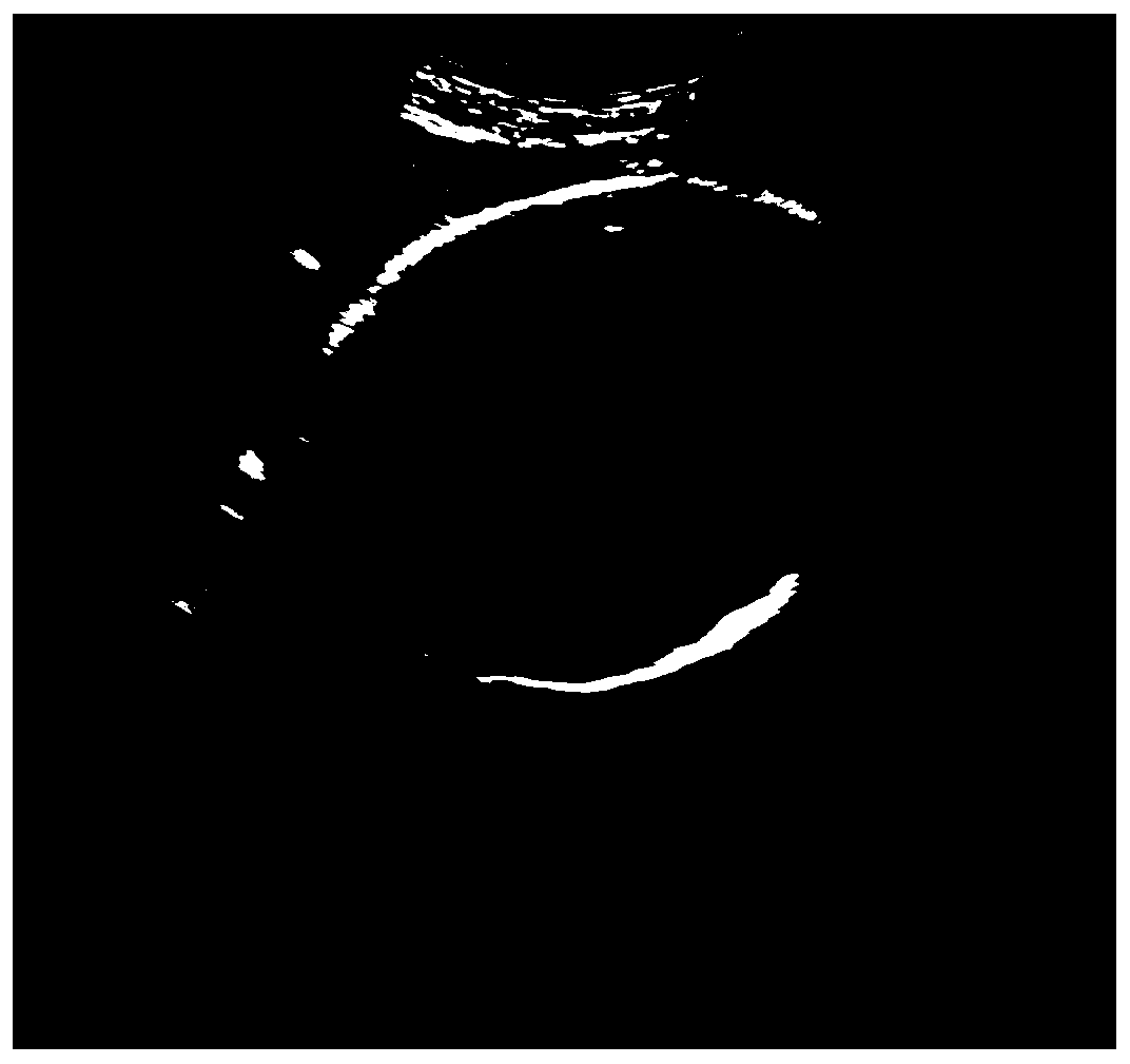 Method and device for measuring fetal head circumference in ultrasound image