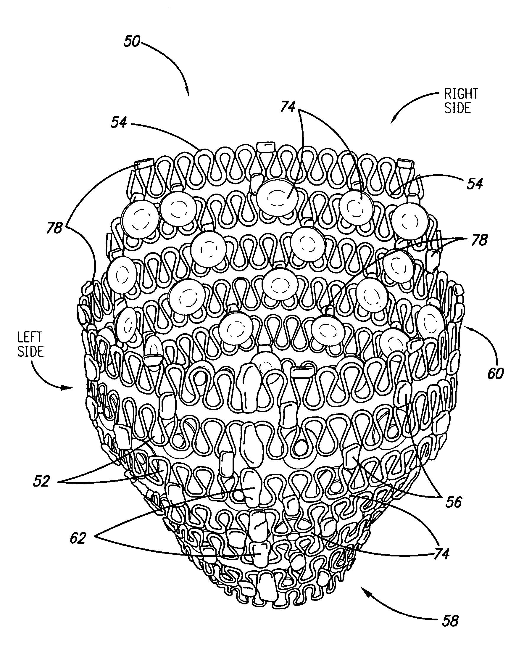 Self-anchoring cardiac harness